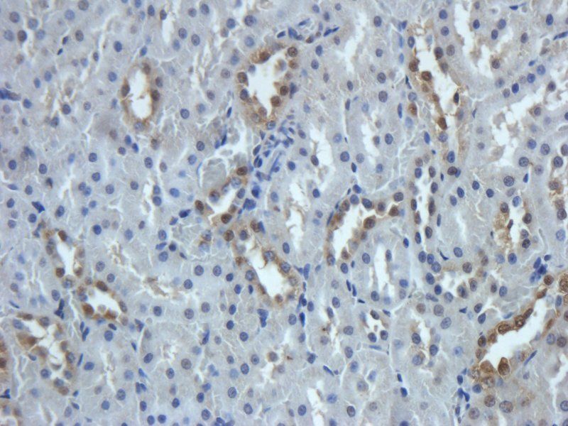 GPR1 antibody