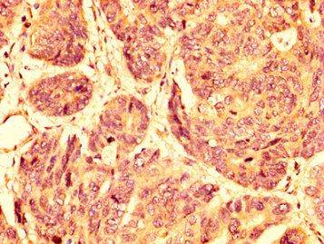 GPR32 Antibody