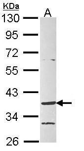 Endothelin 1 antibody