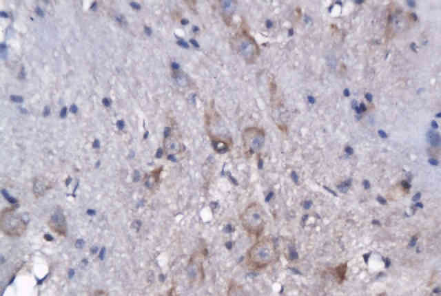 GPR55 antibody