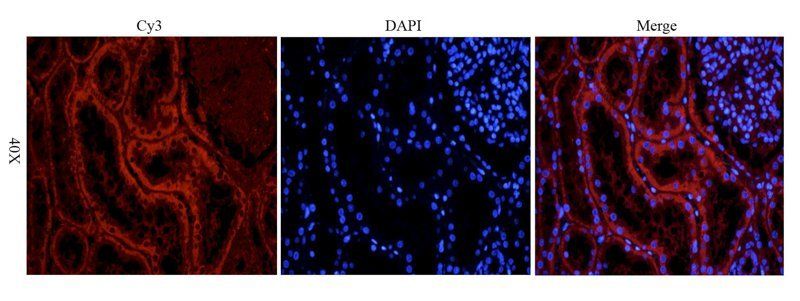 GPR55 antibody