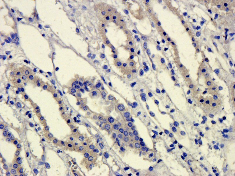 GPR55 antibody