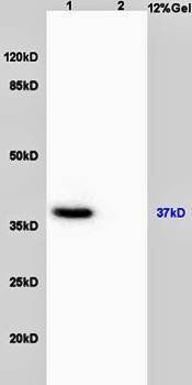 GPR65 antibody