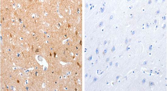 GPR6 Antibody