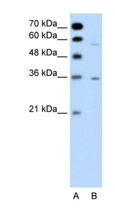 GPRC5A antibody