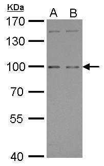 PTGFRN antibody