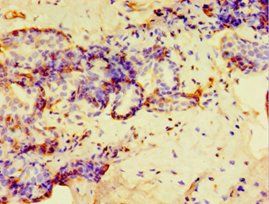 GPS1 Antibody