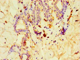 GPS1 Antibody