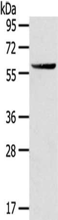 GPT antibody