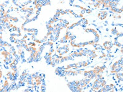 GPT Antibody