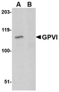 GPVI Antibody