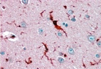 Goat anti-Glutathione Peroxidase 1 (isoform1) Antibody