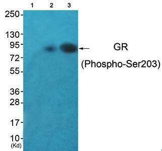 Glucocorticoid Receptor (phospho-Ser203) antibody