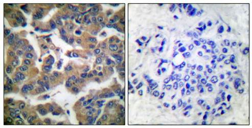 GR (Phospho-Ser211) Antibody
