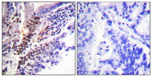 GR (Phospho-Ser226) Antibody
