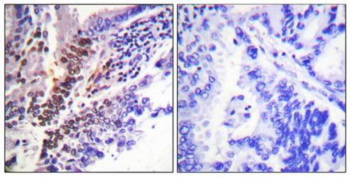 Glucocorticoid Receptor (phospho-Ser226) antibody