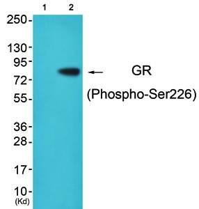Glucocorticoid Receptor (phospho-Ser226) antibody