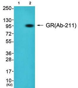 Glucocorticoid Receptor antibody