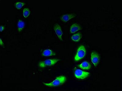 GRAMD1B Antibody