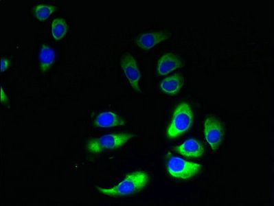 GRAMD1B antibody