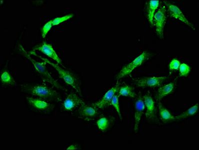 Granzyme B antibody