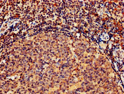 GZMB Antibody