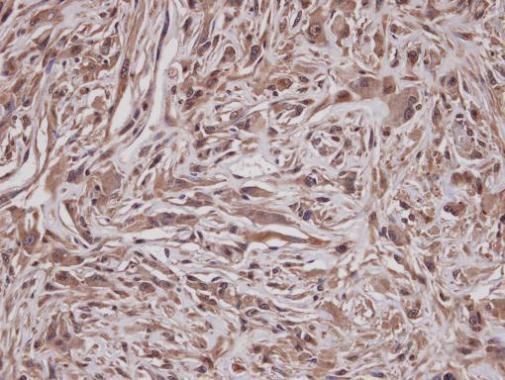 GRAP antibody [C2C3], C-term