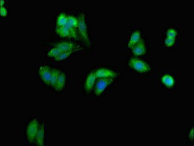 GRB10 antibody