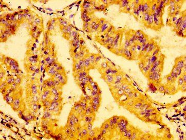 GRB14 Antibody