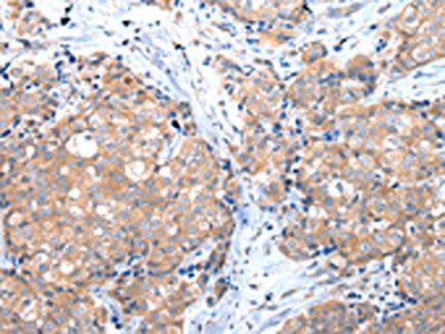 GRB14 Antibody