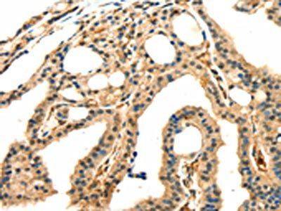 GRB2 Antibody