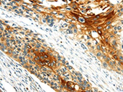 GRB2 Antibody