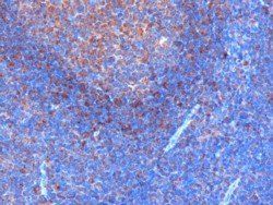 GRB2 antibody