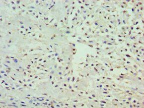 GRB7 Antibody