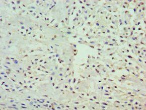 GRB7 antibody