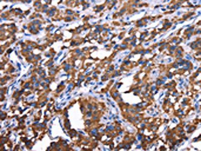 GREB1 Antibody