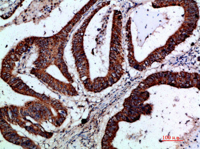 GREM2 antibody