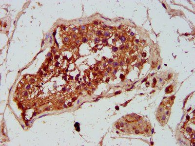 GREM1 Antibody