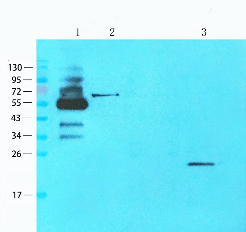 Gremlin 1 antibody