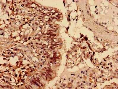 GRHL2 Antibody