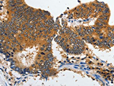 GRIA2 Antibody