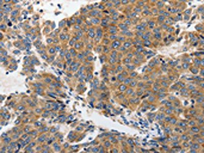GRIA2 Antibody
