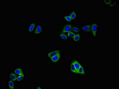 GRIA4 Antibody