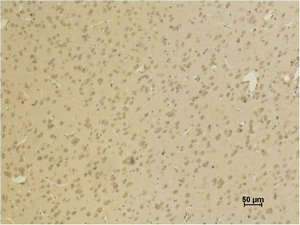 GRIA4 Antibody