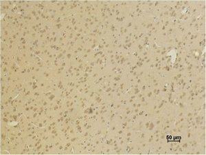 GRIA4 antibody