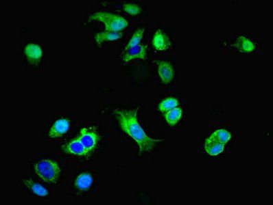 GRID2IP Antibody