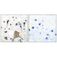 GRIK1 Antibody