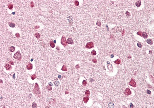 Goat anti-GLuR5 / GRIK1 Antibody