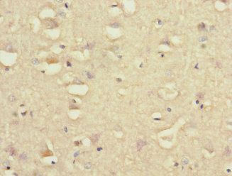 GRIK3 Antibody
