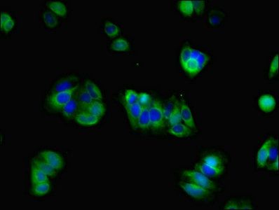 GRIN2A Antibody